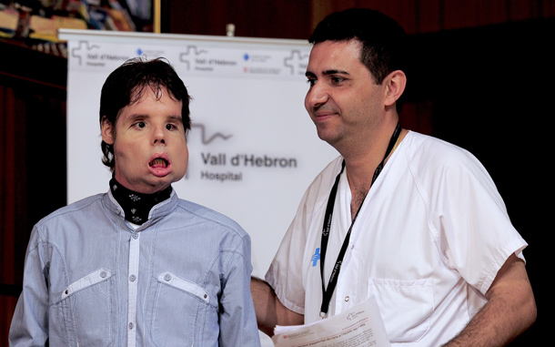 A 30-member medical team led by the Spanish doctor Joan Barret, right, carried out the world’s first full-face transplant on Oscar at the Vall d'Hebron Hospital in Barcelona. Oscar was injured in a shooting accident five years ago. (AP)