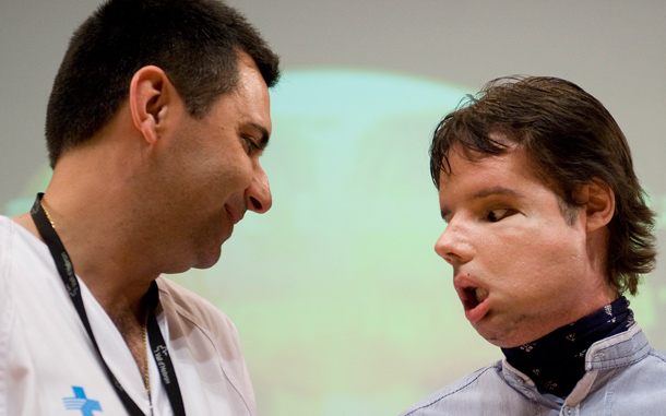 Oscar, the world's first full face transplant recipient, with medical staff at the Vall d'Hebron hospital in Barcelona. “Bit by bit he is improving but he nonetheless has a long and difficult road ahead to have intelligible speech like he had before,” Dr Barret said. (GETTY IMAGES)