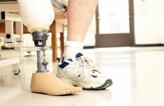 Ontario man wants his leg returned - Offbeat - Emirates24|7