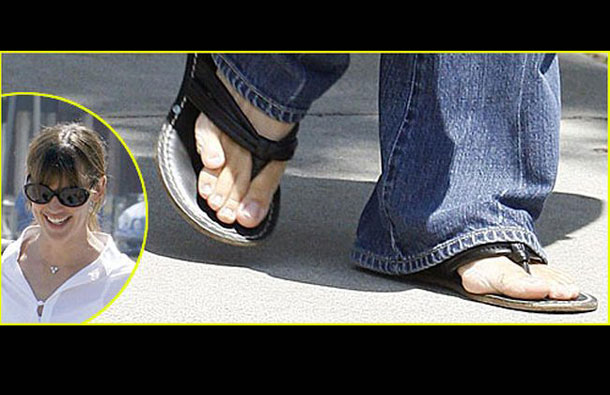 Jennifer Garner has an overlapping pinky toe on her right foot. (AGENCY)
