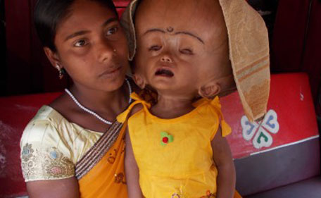 Roona Begum with her mother Fatima Khatun. (WEB PAGE)